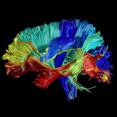 A brain showing colorized fiber tracts