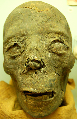 Well preserved mummy at the Semmelweiss Medical Museum