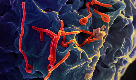 Scanning electron micrograph of budding Ebola virus; NIAID photo