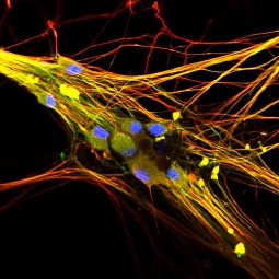 Human stem cell-derived sensory neurons, fluorescently labeled to reveal neurofilament proteins (red and green) and cell nuclei (blue).