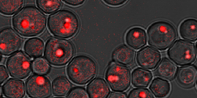 Lipid droplets in fld1 mutant images by CARS