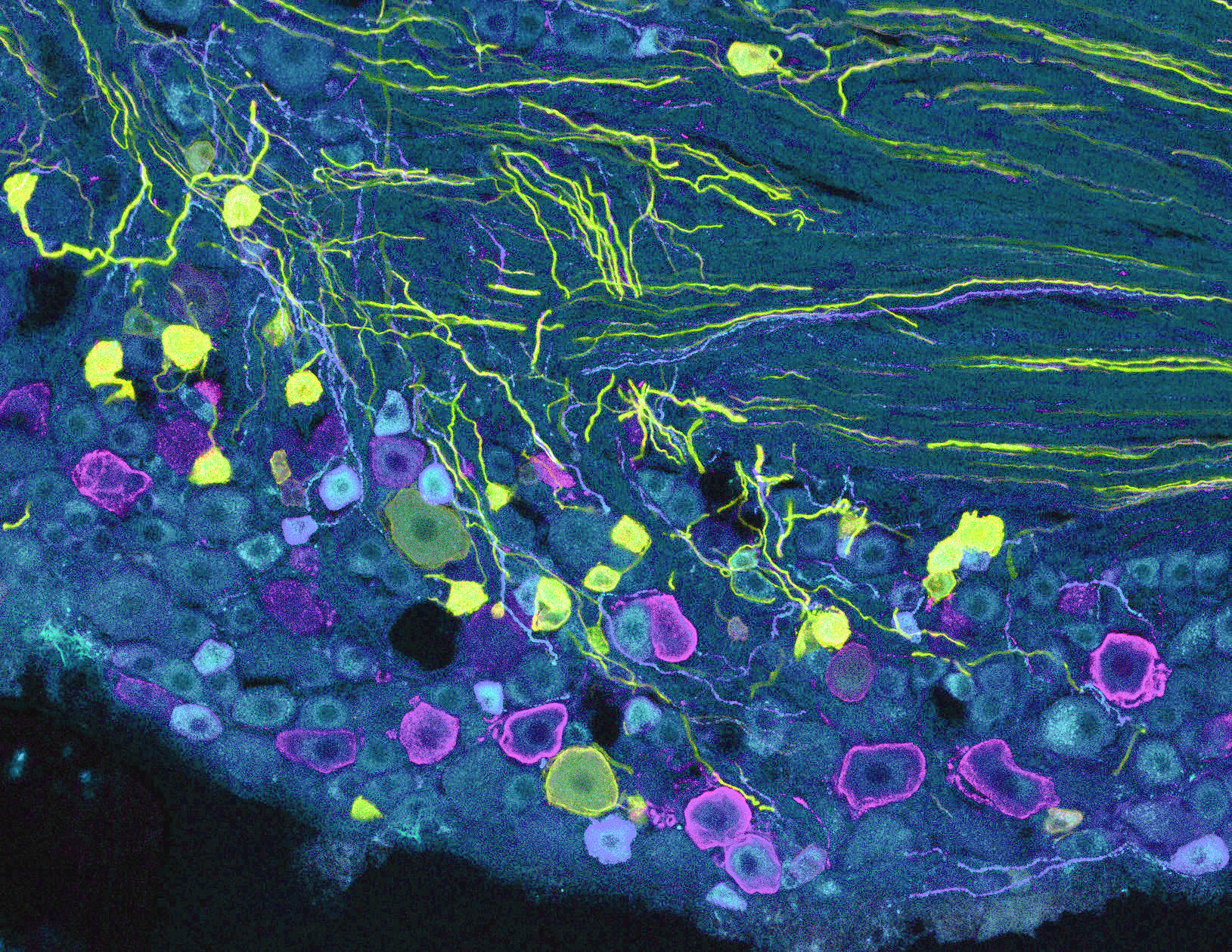 Optimigenetics-Nerve-Image-2