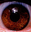 Photo of the anterior view of human right cornea