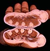 Photo of the transverse section of proximal third of hand, partially dissected