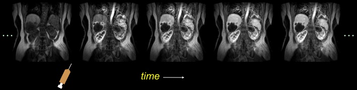 File:AbdominalDCE.jpg