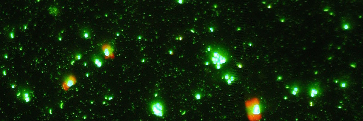 Courtesy of Jed Furhman - epifluorescence microscopy image of marine microbes