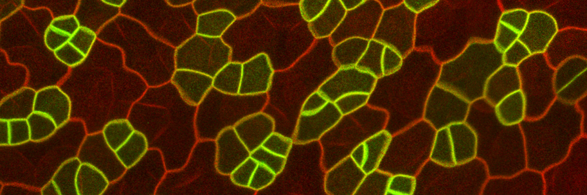 Courtesy of Dominique Bergmann - plant cells