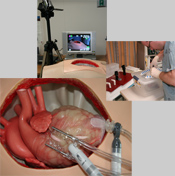 Simulated Cardiac Surgery