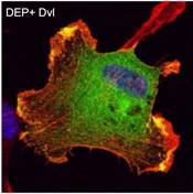 Ednothelial cell transfected with DEP+ Dvl 