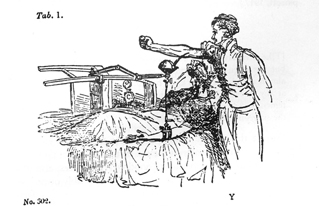 Image of early transfusion