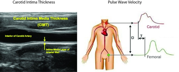 Figure 4. CIT-PWV