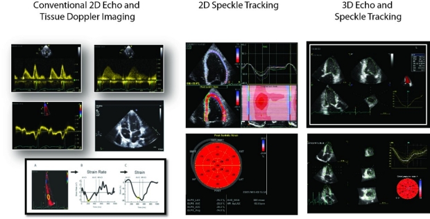 Figure 3. Echo