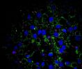 Clearing clumps of protein in aging neural stem cells boosts their activity