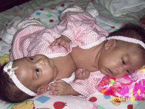 Sabuco Twins at 3 months