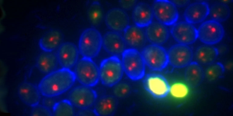 San1 strain visualized with FUN and calcofluor white