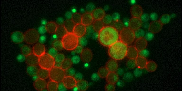 Localization of Ace2-GFP to daughter cell nuclei