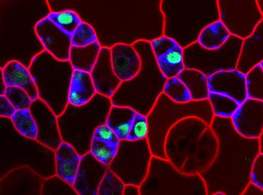 Confocal image of the Arabidopsis thaliana epidermis highlighting the origin of stomatal lineage stem cells.