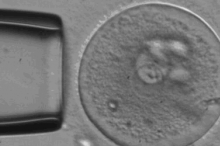 Photo of embryo and pipette.