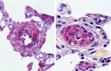 PH cells