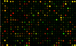 Gene Expression Profiling, Genotyping & Genomic Analysis