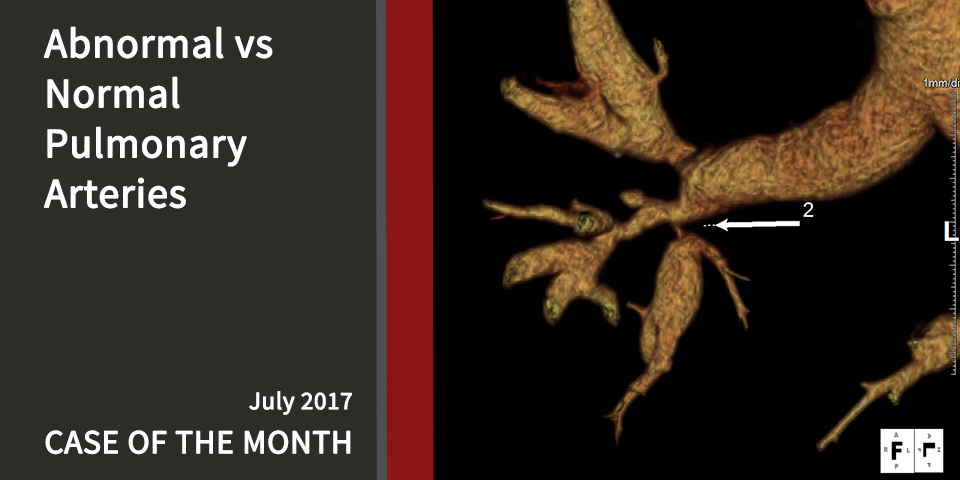 Abnormal-Arteries-July