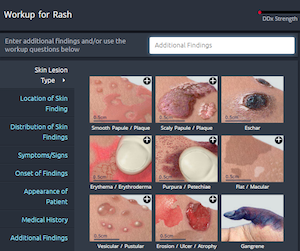 VisualDX Rash Workup