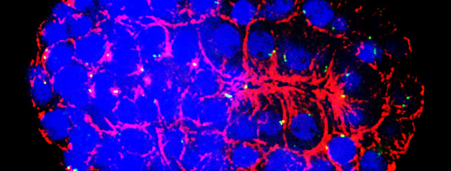 embryonic intestinal cells, in which microtubules (red) are arranged at the apical membrane and not at nearby centrosomes (green)