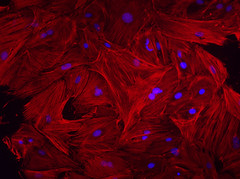 Mouse heart fibroblasts