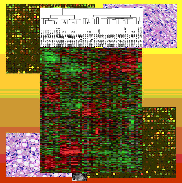 Molecular characterisation of soft tissue tumours: a gene expression study.