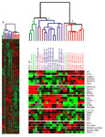 Gastrointestinal stromal tumors (GISTs) with KIT and PDGFRA mutations have distinct gene expression profiles