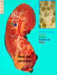 Gene expression in the normal adult human kidney assessed by complementary DNA microarray.