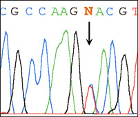 Heterozygous mutation in exon 9 of the FGFR2 gene (C342Y)