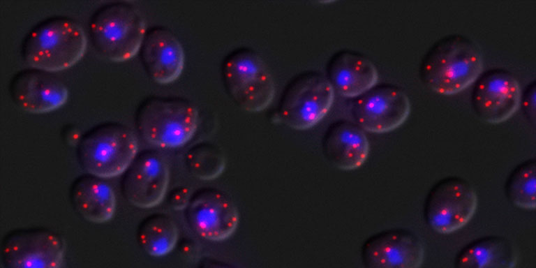 Single MDN1 mRNAs detected by FISH